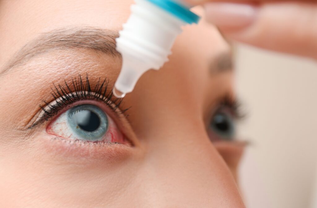 A close-up image of an adult applying eye drops to their red, irritated eye after checking the expiry date.