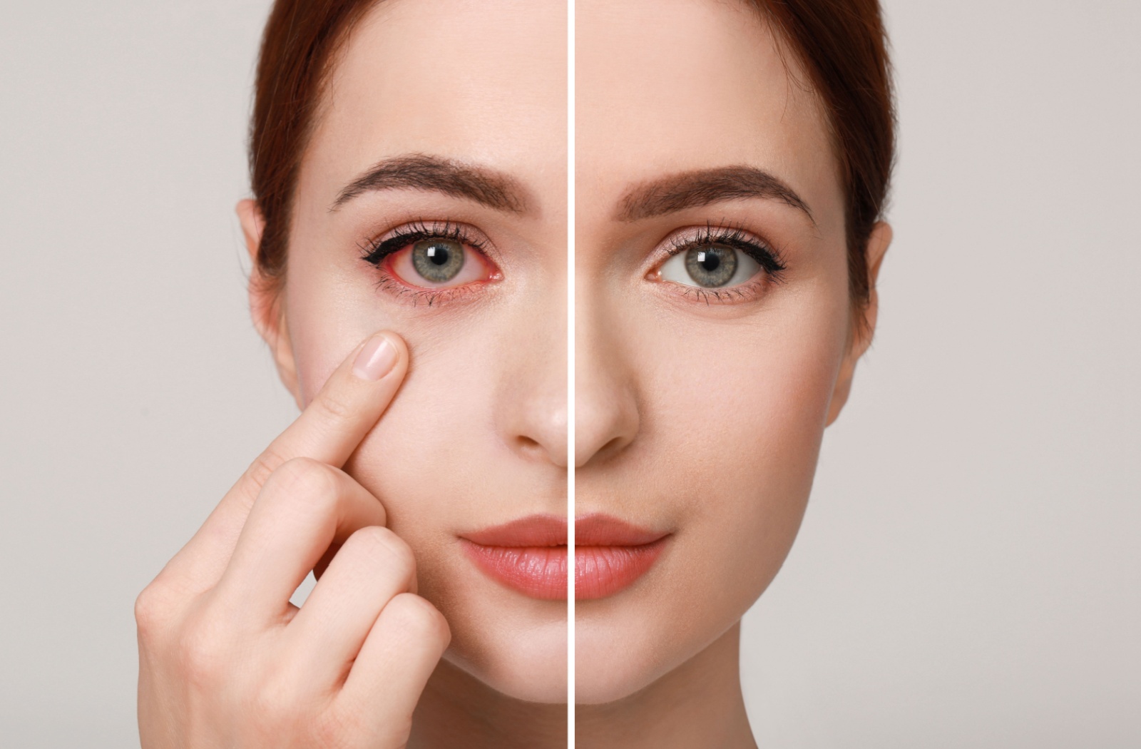 Split screen image showing a patient with and without conjunctivitis caused by a sinus infection.